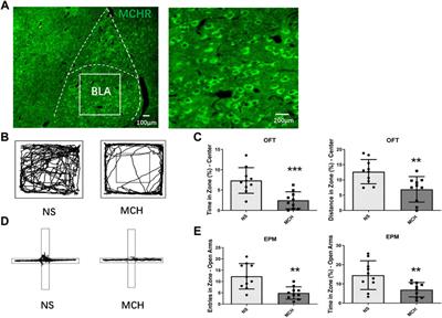 Melanin-concentrating hormone promotes anxiety and intestinal dysfunction via basolateral amygdala in mice